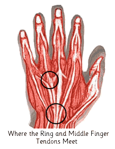 Where the Ring and Middle Finger Tendons Meet