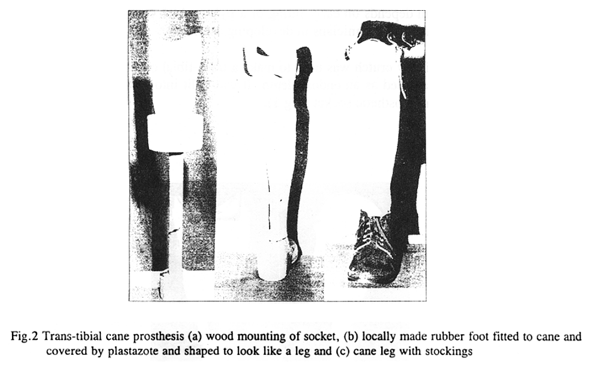 Fig.2 Trans-tibial cane prosthesis