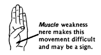 Muscle weakness here makes this movement difficult and may be a sign.