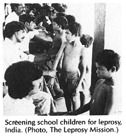Screening school children for leprosy, India.