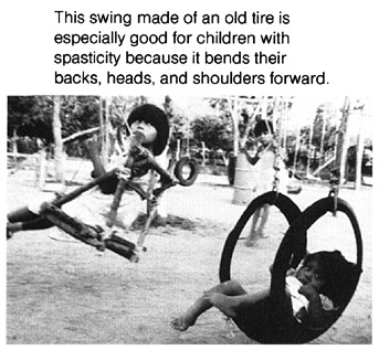 This swing made of an old tire is especially good for children with spasticity.