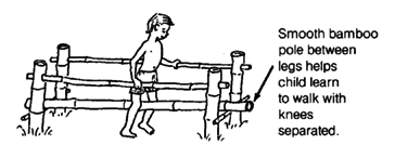 parallel bars for a child whose knees pull together.