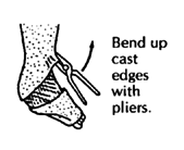 Bend up cast edges with pliers.