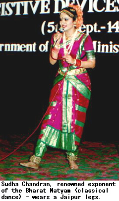Sudha Chandran, renowned exponent of the Bharat Natyam (classical dance) - wears a Jaipur leg.