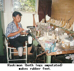 Raskiman (both legs amputated) makes rubber feet.