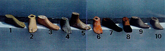 We have ten models of prosthetic feet.