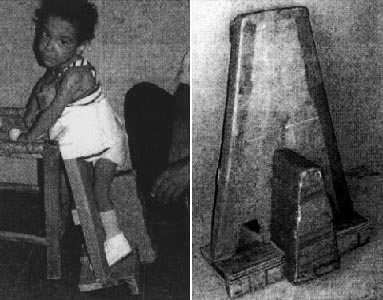 A standing-frame made of cardboard provides more gentle support for bony areas such as Cruz's knees.