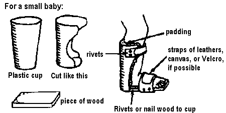 For a small baby: Cut a plastic cup in the shape of backside of his leg, and put a padding, straps and a piece of wood as a sole.