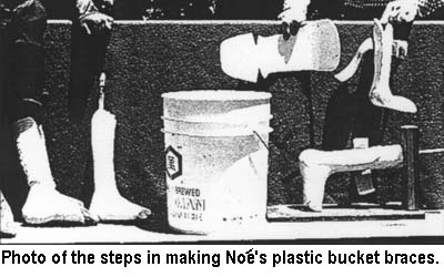 Photo of the steps in making Noés's plastic bucket braces.