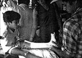 Marcelo takes a plaster-cast of Noe's leg.