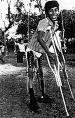Noe was delighted with his new plastic braces.