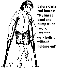 Before Carla had braces: "My knees bend and bump when I walk. I want to walk better, without holding on!"