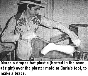 Marcelo drapes hot plastic (heated in the oven, at right) over the plaster mold of Carla's foot, to make a brace.