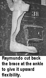"It does not hurt now!" says Neto to Raymundo, the brace maker.
