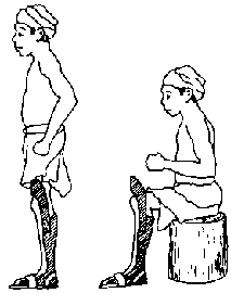 When the person sits or squats, the top part of the brace sticks out above the knee.