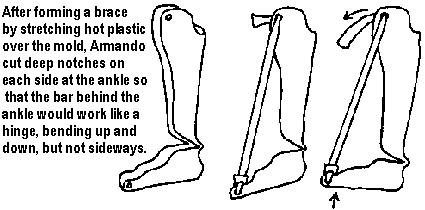 After forming a brace by stretching hot plastic over the mold, Armando cut deep notches on each side at the ankle so that the bar behind the ankle would work like a hinge, bending up and down, but not sideways.