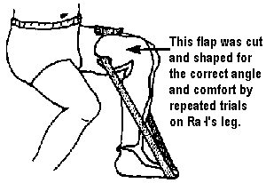 This flap was cut and shaped for the correct angle and comfort by repeated trials on Raul's leg.