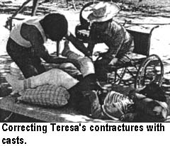 Correcting Teresa's contractures with casts.
