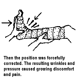 Then the position was forcefully corrected. The resulting wrinkles and pressure caused growing discomfort and pain.