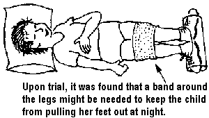 Upon trial, it was found that a band around the legs might be needed to keep the child from pulling her feet out at night.