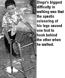 Diego's biggest difficulty in walking was that the spastic scissoring of his legs caused one foot to hook behind the other when he walked.