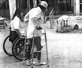Testing his new leg by walking with his walker.