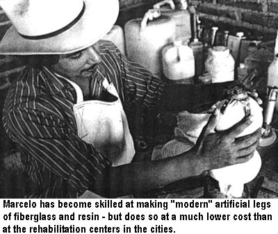 Marcelo has become skilled at making "modern" artificial legs of fiberglass and resin - but does so at a much lower cost than at the rehabilitation centers in the cities.