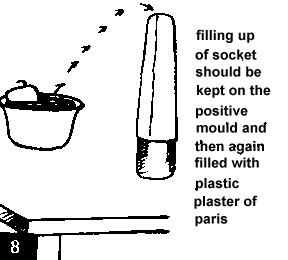 Figure 8. Filling up of socket should be kept on the positive mould and then again filled with plastic plaster of paris.