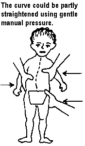 The curve could be partly straightened using gentle manual pressure.