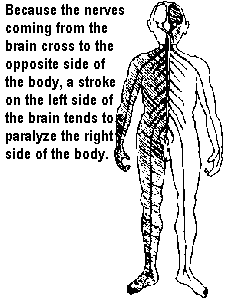 Because the nerves coming from the brain cross to the opposite side of the body, a stroke on the left side of the brain tends to paralyze the right side of the body.