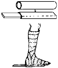 To make the heel bar removable and adjustable.