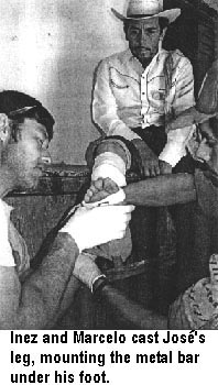 Inez and Marcelo cast Joses's leg, mounting the metal bar under his foot.