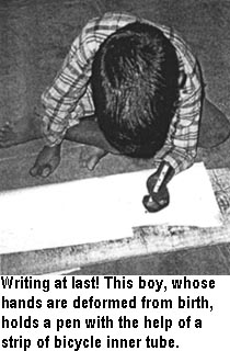 Writing at last! This boy, whose hands are deformed from birth, holds a pen with the help of a strip of bicycle inner tube.