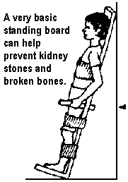 A very basic standing board can help prevent kidney stones and broken bones.