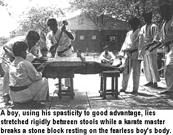 A boy, using his spasticity to good advantage, lies stretched rigidly between stools while a karate master breaks a stone block resting on the fearless boy's body.