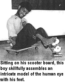 Sitting on his scooter board, this boy skillfully assembles an intricate model of the human eye with his feet.