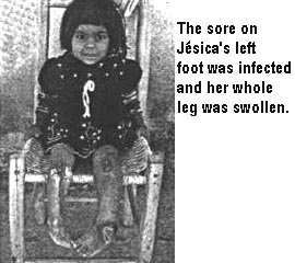 The sore on Jésica's left foot was infected and her whole leg was swollen.