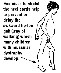 Exercises to stretch the heel cords help to prevent or delay the awkward tip-toe gait (way of walking) which many children with muscular dystrophy develop.