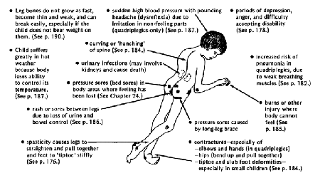 Common secondary problems in children with spinal cord injury