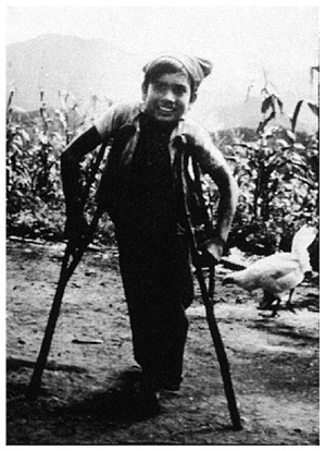 His legs had been paralyzed by polio.