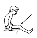 A knee often does not straighten as much with the hips bent.