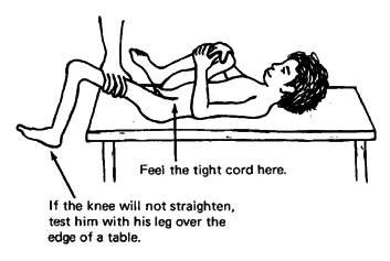 To check how far the hip joint straightens, have the child hold his other knee to his chest.