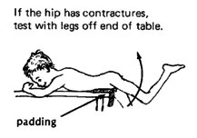 If the hip has contractures, test with legs off end of table.