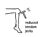 Reduced tendon jerks.