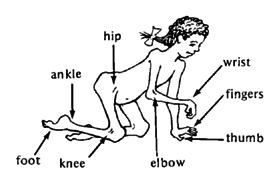 TYPICAL CONTRACTURES IN POLIO
