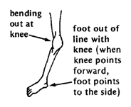 OVER-STRETCHED JOINTS (bending out at knee, foot out of line with knee)