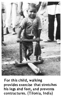  For this child, walking provides exercise that stretches his legs and feet, and prevents contractures. (Tilonia, India)