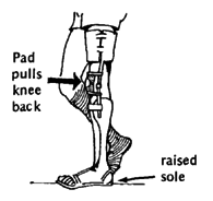 Pad pulls knee back.