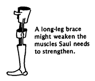 A long-leg brace might weaken the muscles Saul needs to strengthen.