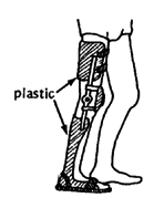 Long-leg brace of plastic